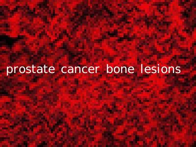 prostate cancer bone lesions